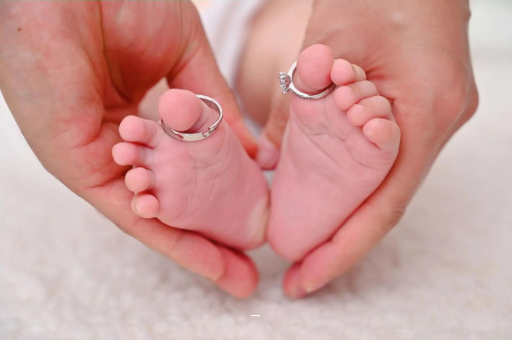 新安孕妇怎样预防妊娠纹